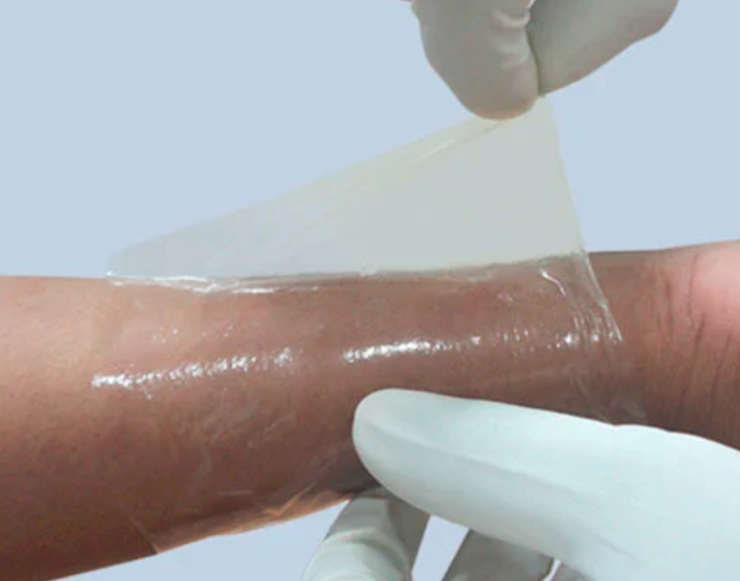 ABSCURE COLLAGEN WOUND DRESSING