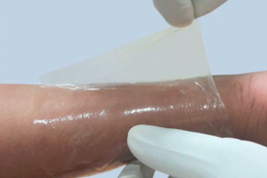 ABSCURE COLLAGEN WOUND DRESSING