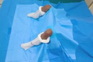 Bilateral Surgical Drape - Sterile Disposable Drape by Prakhar Medics