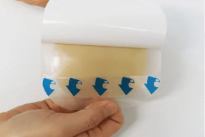 HYDROCOLLOID DRESSING