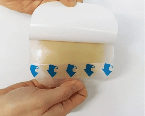 HYDROCOLLOID DRESSING