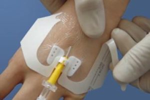IV DRESSING